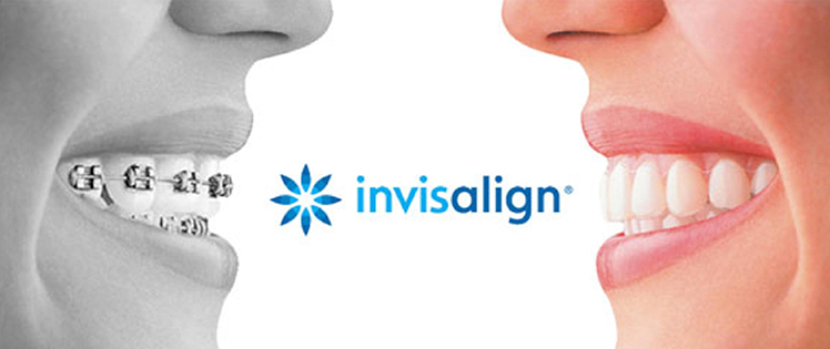 invisalign dentista madrid